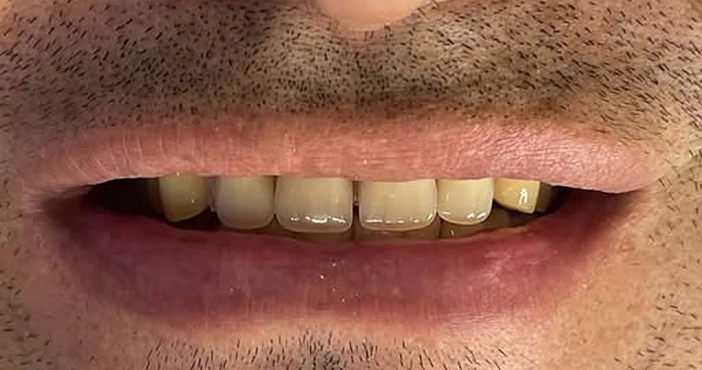 Después: dientes parejos y armónicos
